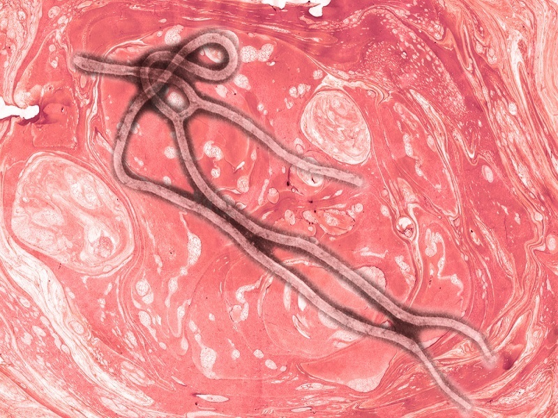 EU team successfully maps genetic evolution of Ebola virus