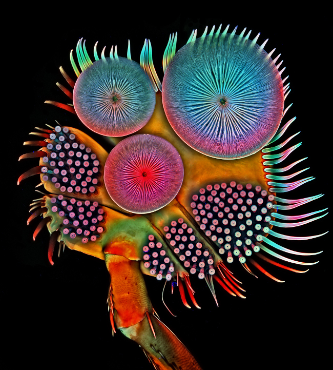 5th Place – Front foot (tarsus) of a male diving beetle in confocal at 100x. Image: Dr. Igor Siwanowicz/ Nikon Small World Photomicrography Competition