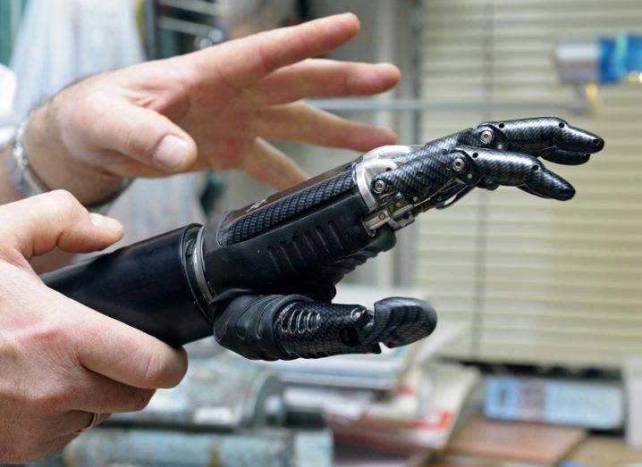 Pair of hands holding a black prosthetic hand in a lab.