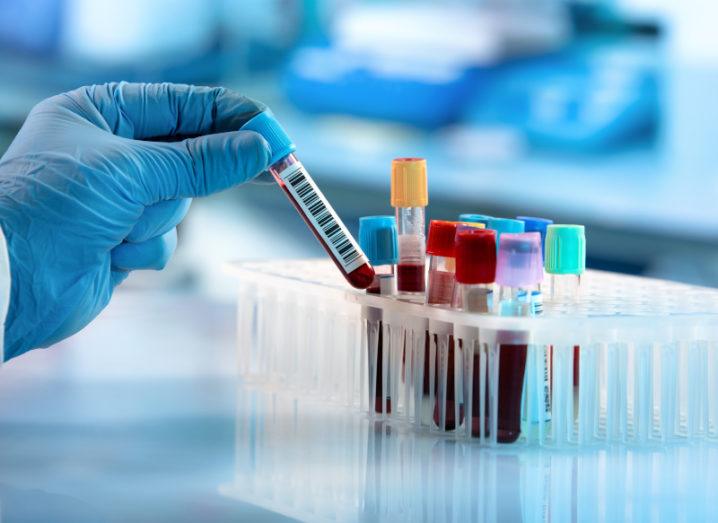 A gloved hand holds a vial of blood beside a small rack of other vials of blood samples in a lab.