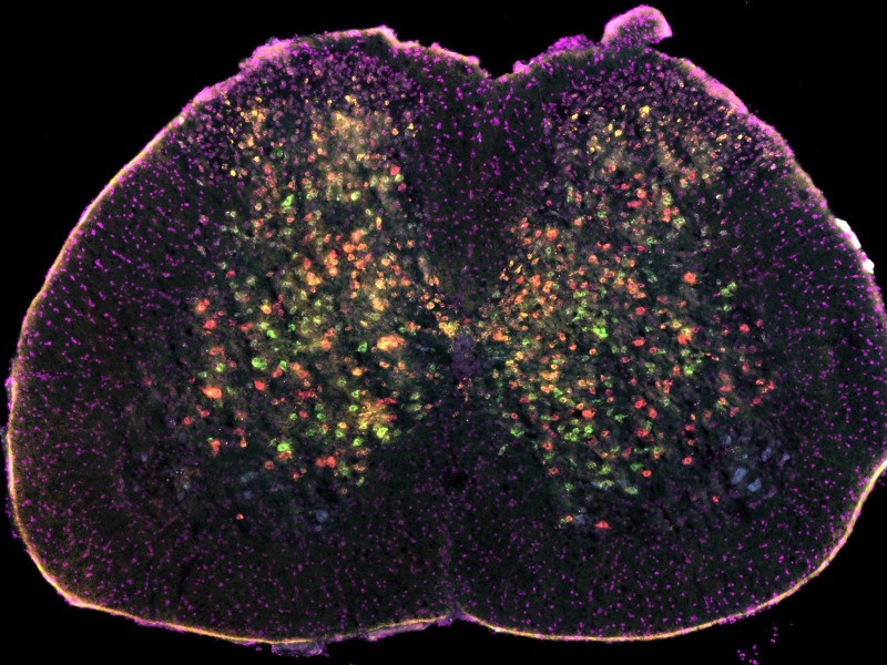 An image of a spinal cord with lights showing different motor neurons, from a study on ALS.