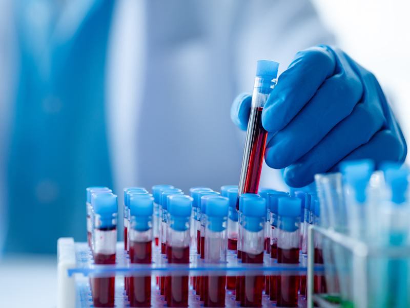 A scientist with a gloved hand holds a test tube of blood to run an experiment.