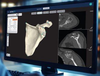 Axial3D raises $18.2m to expand medical-imaging tech