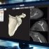 Axial3D raises $18.2m to expand medical-imaging tech